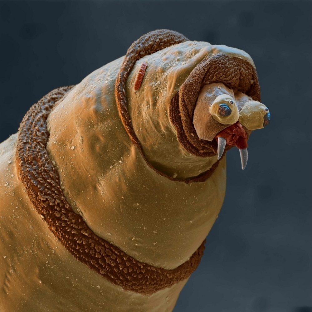 1000x1000, 241 Kb / муха, личинка, труп, микроскоп, фото