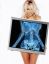 рентген, Памела Андерсон, Pamela Anderson, снимок
